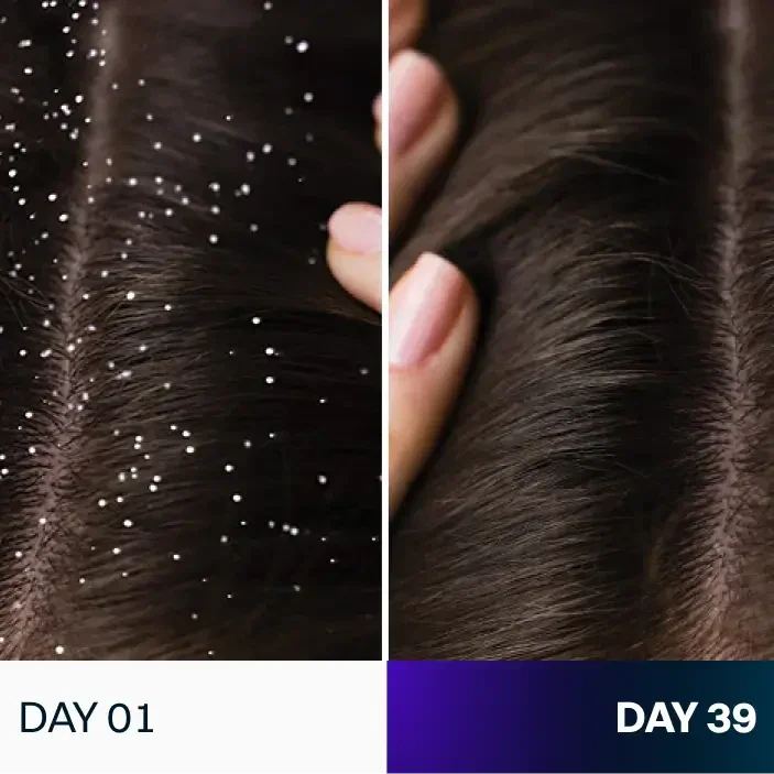 The Derma Showerhead