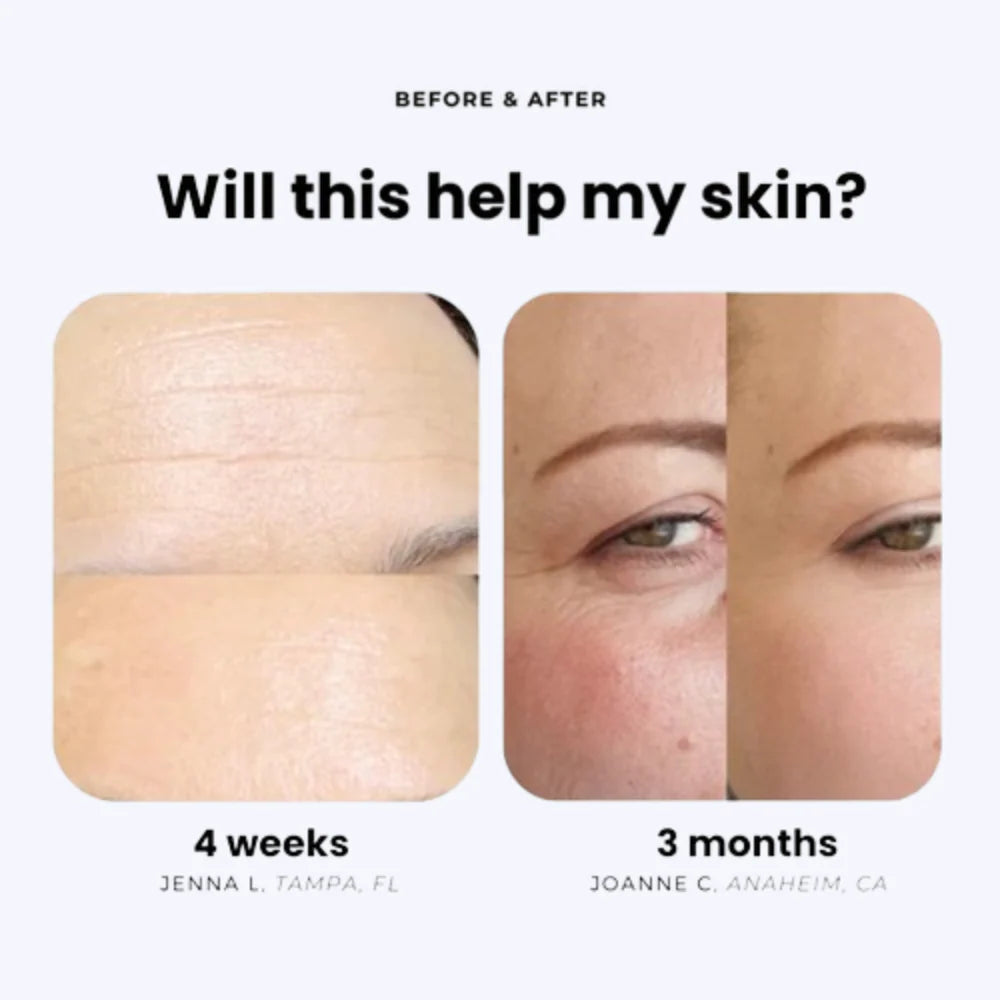 The Derma Showerhead