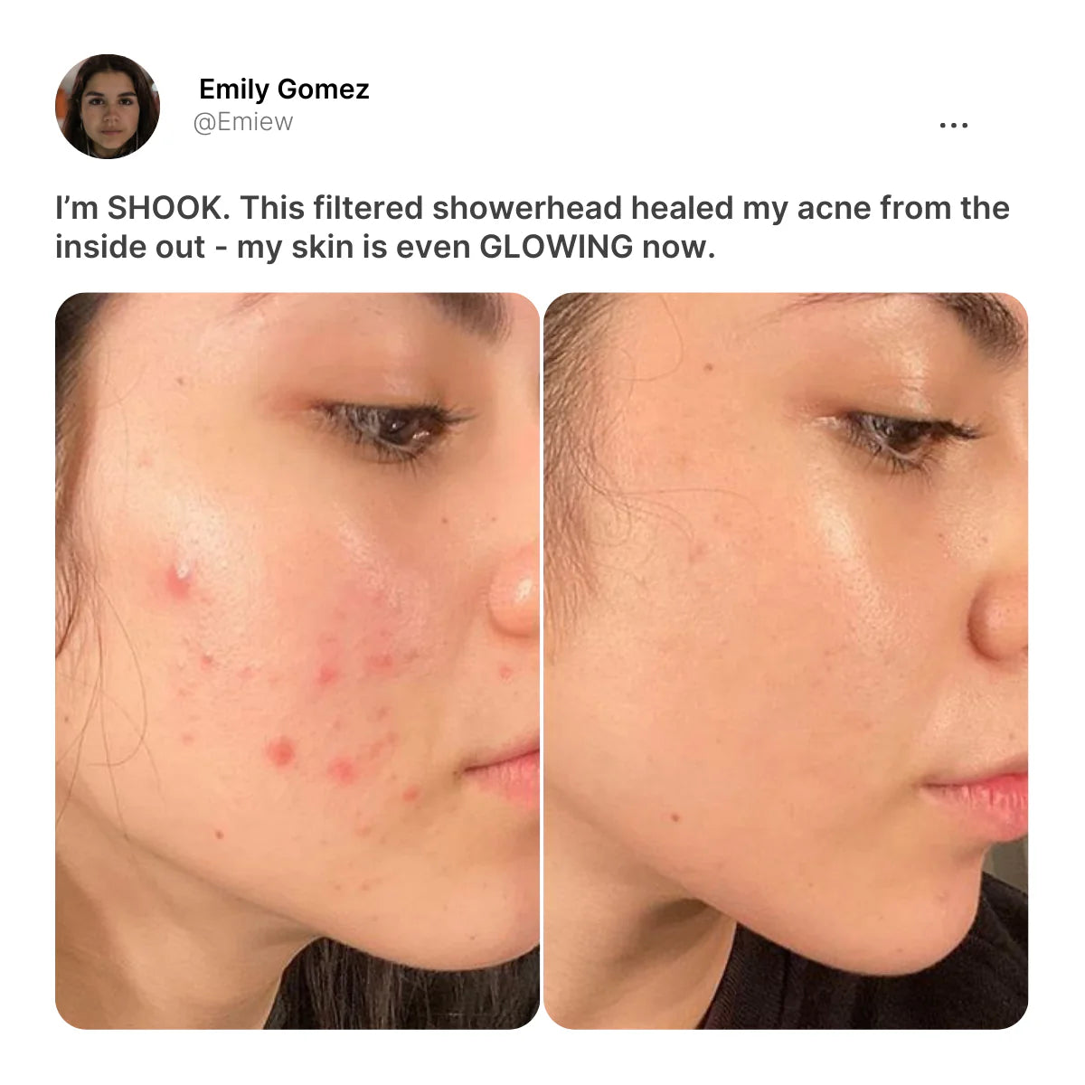 The Derma Showerhead