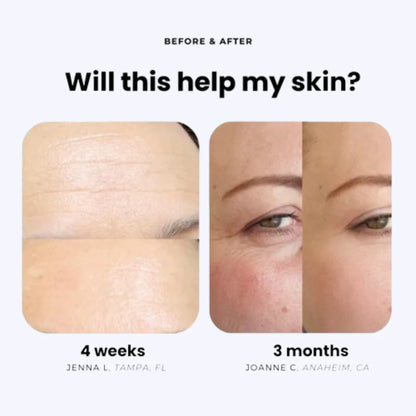 The Derma Showerhead
